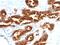 TAG-72 antibody, MBS438112, MyBioSource, Immunohistochemistry frozen image 