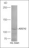 Adenylate Cyclase 2 antibody, orb5791, Biorbyt, Western Blot image 