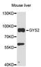 Glycogen Synthase 2 antibody, LS-C748083, Lifespan Biosciences, Western Blot image 