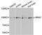 B-Raf Proto-Oncogene, Serine/Threonine Kinase antibody, A0038, ABclonal Technology, Western Blot image 