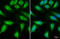 Malonyl-CoA decarboxylase, mitochondrial antibody, GTX110037, GeneTex, Immunocytochemistry image 