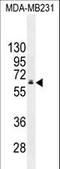 HNF1 Homeobox B antibody, LS-C164946, Lifespan Biosciences, Western Blot image 