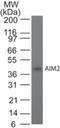 Absent In Melanoma 2 antibody, NBP2-27354, Novus Biologicals, Western Blot image 