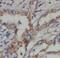 Copine 8 antibody, FNab01931, FineTest, Immunohistochemistry paraffin image 