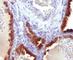 Keratin 7 antibody, V7104IHC-7ML, NSJ Bioreagents, Immunohistochemistry frozen image 