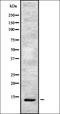 Cholinergic Receptor Nicotinic Alpha 4 Subunit antibody, orb337098, Biorbyt, Western Blot image 