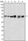AKT Serine/Threonine Kinase 2 antibody, abx010368, Abbexa, Western Blot image 