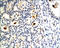 Estrogen Receptor 1 antibody, 250638, Abbiotec, Immunohistochemistry paraffin image 