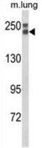 Collagen Type XVIII Alpha 1 Chain antibody, GTX80984, GeneTex, Western Blot image 