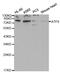 Activating Transcription Factor 6 antibody, MBS125729, MyBioSource, Western Blot image 