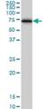 Cystathionine-Beta-Synthase antibody, H00000875-M01, Novus Biologicals, Western Blot image 