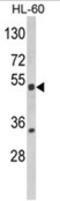 Nuclear Receptor Subfamily 1 Group I Member 2 antibody, AP18142PU-N, Origene, Western Blot image 