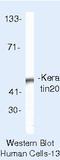 Keratin 20 antibody, MA5-13263, Invitrogen Antibodies, Western Blot image 