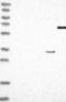 Ribokinase antibody, NBP1-84115, Novus Biologicals, Western Blot image 
