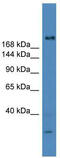 Ubiquitin Specific Peptidase 9 Y-Linked antibody, TA342578, Origene, Western Blot image 