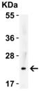 Interleukin 23 Subunit Alpha antibody, A01097, Boster Biological Technology, Western Blot image 