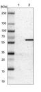 Activin A Receptor Type 1C antibody, NBP1-90252, Novus Biologicals, Western Blot image 