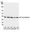 Transaldolase 1 antibody, A304-326A, Bethyl Labs, Western Blot image 