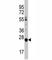 Lin-28 Homolog B antibody, F44236-0.4ML, NSJ Bioreagents, Western Blot image 
