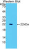 CD177 Molecule antibody, LS-C314662, Lifespan Biosciences, Western Blot image 