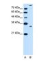 Granzyme K antibody, NBP1-69353, Novus Biologicals, Western Blot image 