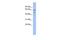 G Protein Nucleolar 3 antibody, GTX44809, GeneTex, Western Blot image 