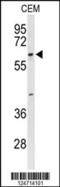 Trichoplein Keratin Filament Binding antibody, 63-907, ProSci, Western Blot image 