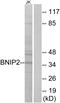 BCL2 Interacting Protein 2 antibody, GTX87240, GeneTex, Western Blot image 