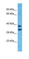 Olfactory Receptor Family 8 Subfamily H Member 1 antibody, orb327058, Biorbyt, Western Blot image 