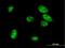 Mesenchyme Homeobox 1 antibody, H00004222-M07, Novus Biologicals, Immunocytochemistry image 