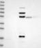 Rhophilin-1 antibody, NBP1-82880, Novus Biologicals, Western Blot image 