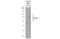 Solute Carrier Family 38 Member 1 antibody, GTX131854, GeneTex, Western Blot image 