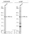 Protein Kinase D1 antibody, GTX133778, GeneTex, Western Blot image 