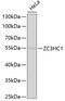 Zinc Finger C3HC-Type Containing 1 antibody, 22-134, ProSci, Western Blot image 