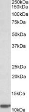 Beta-2-Microglobulin antibody, LS-C155012, Lifespan Biosciences, Western Blot image 