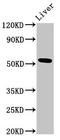Methionyl Aminopeptidase 2 antibody, CSB-PA013716LA01HU, Cusabio, Western Blot image 