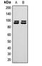 Microtubule Associated Serine/Threonine Kinase Like antibody, LS-C356177, Lifespan Biosciences, Western Blot image 