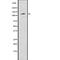 ATP Binding Cassette Subfamily G Member 1 antibody, abx147876, Abbexa, Western Blot image 