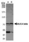 Mucin 4, Cell Surface Associated antibody, PA5-23077, Invitrogen Antibodies, Western Blot image 