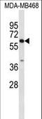 Carboxylesterase 5A antibody, LS-C168692, Lifespan Biosciences, Western Blot image 