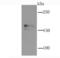 Glutamate Ionotropic Receptor NMDA Type Subunit 2A antibody, NBP2-66984, Novus Biologicals, Western Blot image 