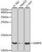 Small Nuclear Ribonucleoprotein Polypeptide E antibody, GTX33511, GeneTex, Western Blot image 