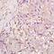 CD49D antibody, orb9092, Biorbyt, Immunohistochemistry paraffin image 