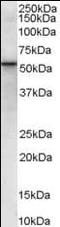 Vacuolar Protein Sorting 45 Homolog antibody, orb95320, Biorbyt, Western Blot image 