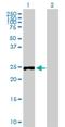 Ribose 5-Phosphate Isomerase A antibody, H00022934-B02P, Novus Biologicals, Western Blot image 