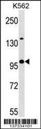 Kelch Like Family Member 4 antibody, 60-089, ProSci, Western Blot image 