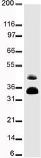 FosB Proto-Oncogene, AP-1 Transcription Factor Subunit antibody, ab11959, Abcam, Western Blot image 