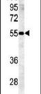 Beta-1,4-Galactosyltransferase 5 antibody, PA5-25282, Invitrogen Antibodies, Western Blot image 