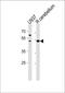 Solute Carrier Family 25 Member 25 antibody, PA5-35293, Invitrogen Antibodies, Western Blot image 