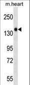 Retinal guanylyl cyclase 2 antibody, LS-C164397, Lifespan Biosciences, Western Blot image 